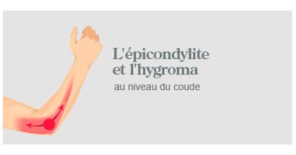 Epicondylite et Hygroma (coude)